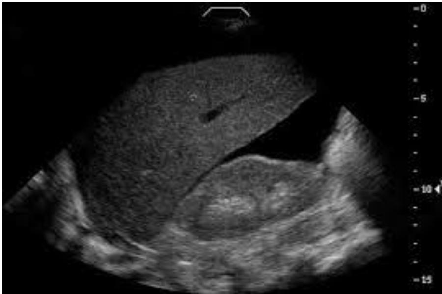 _page_98_Picture_3.jpeg|345x230