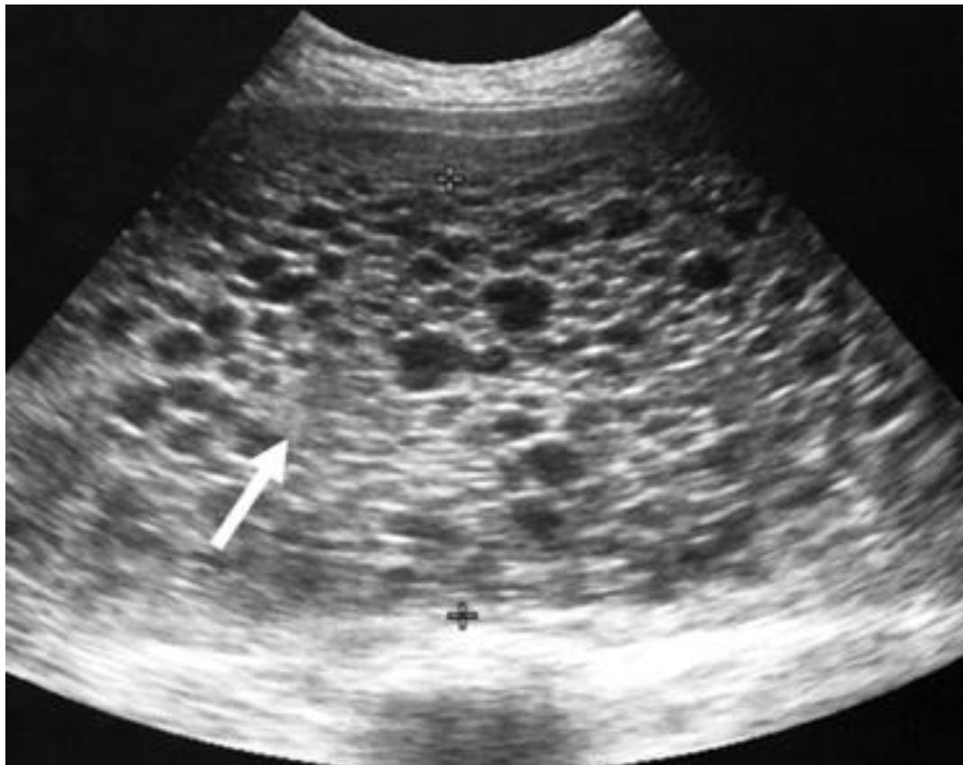 _page_99_Picture_2.jpeg|371x295