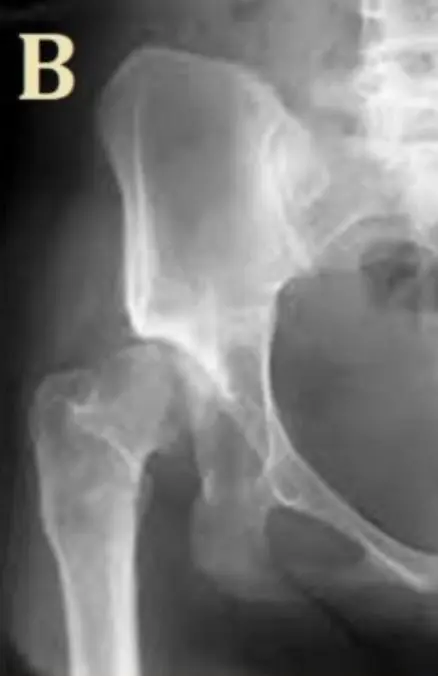 EM-OSPE-1766417425011.webp|271x418