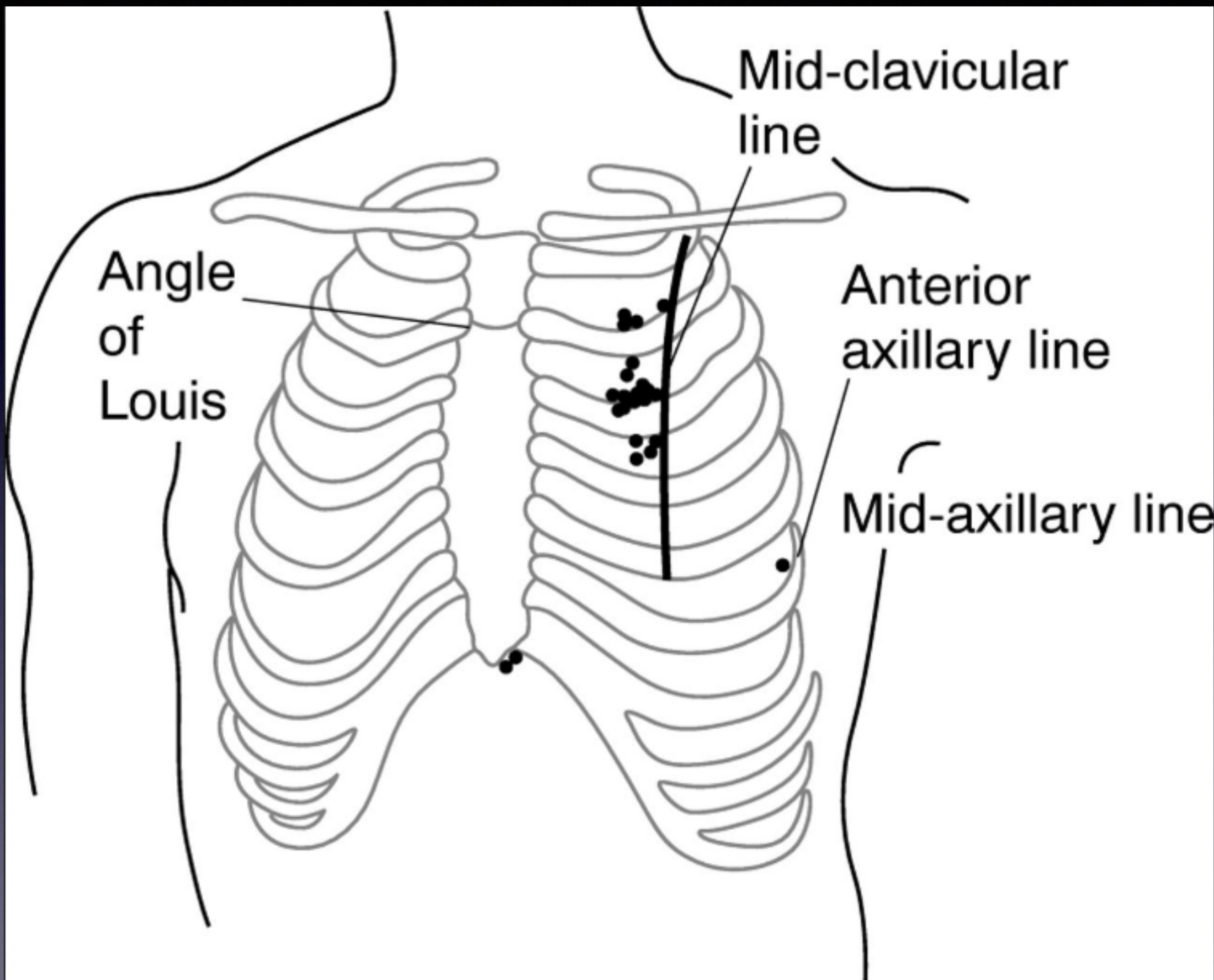 Chest Landmarks