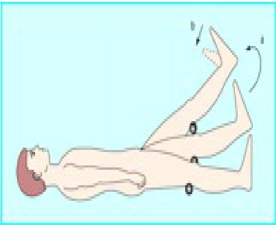 Low back pain img-12