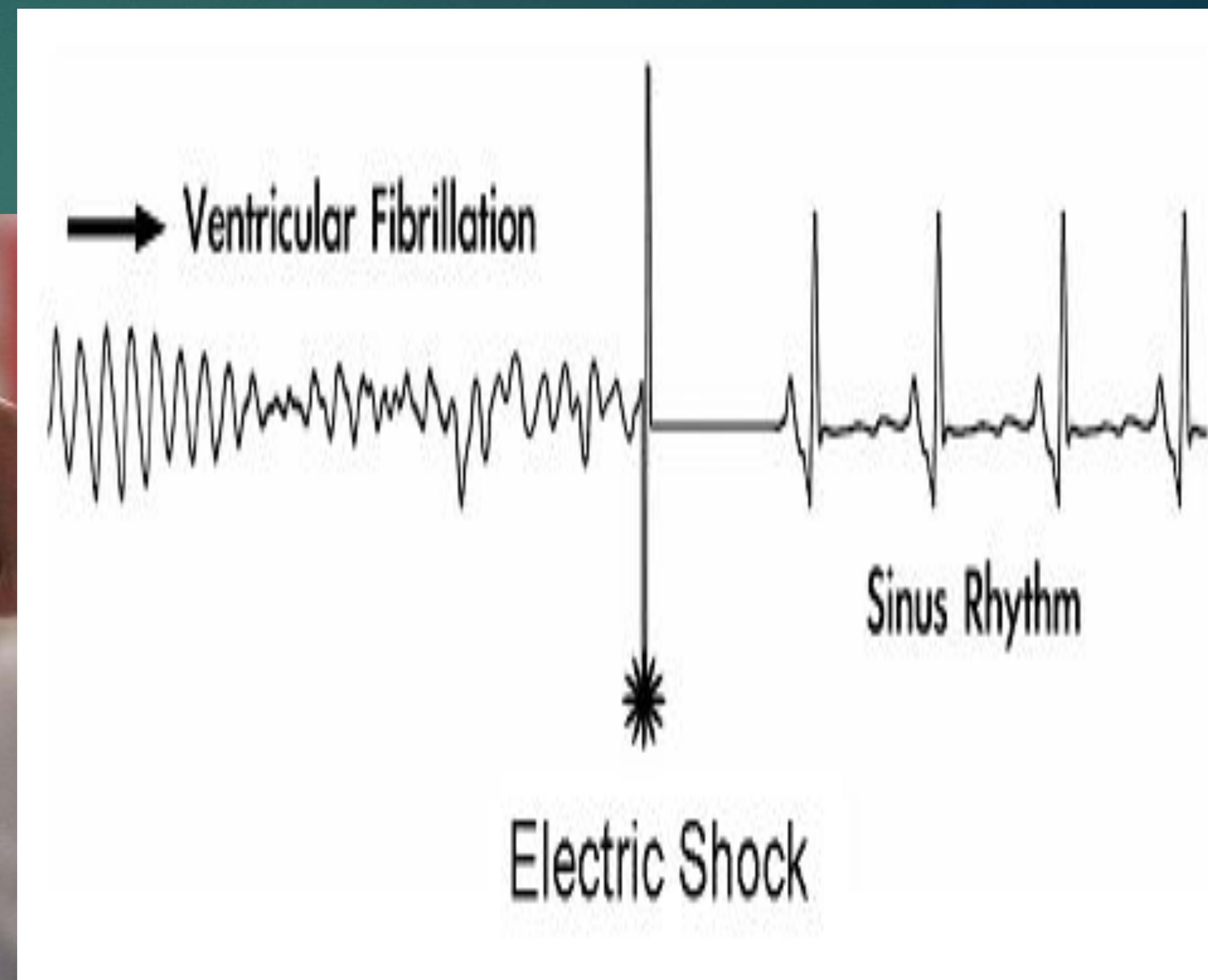 d71ba79c3da3a9767a82812c7eb0b20b_img.jpg|700x194