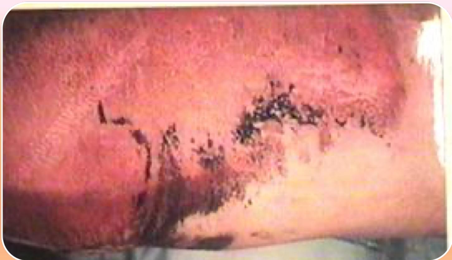 _page_109_Picture_1.jpeg|297x171