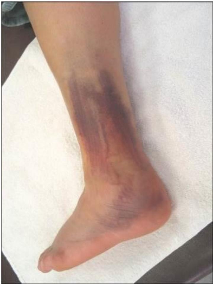 _page_11_Picture_4.jpeg|178x237