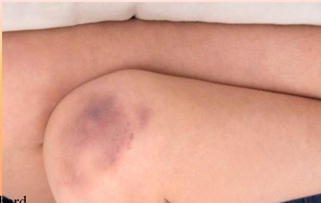 _page_123_Picture_3.jpeg|336x212