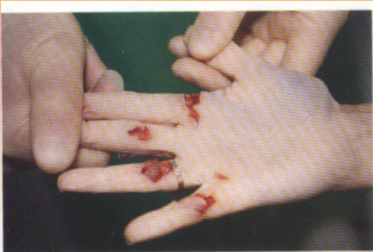 _page_125_Picture_5.jpeg|215x146