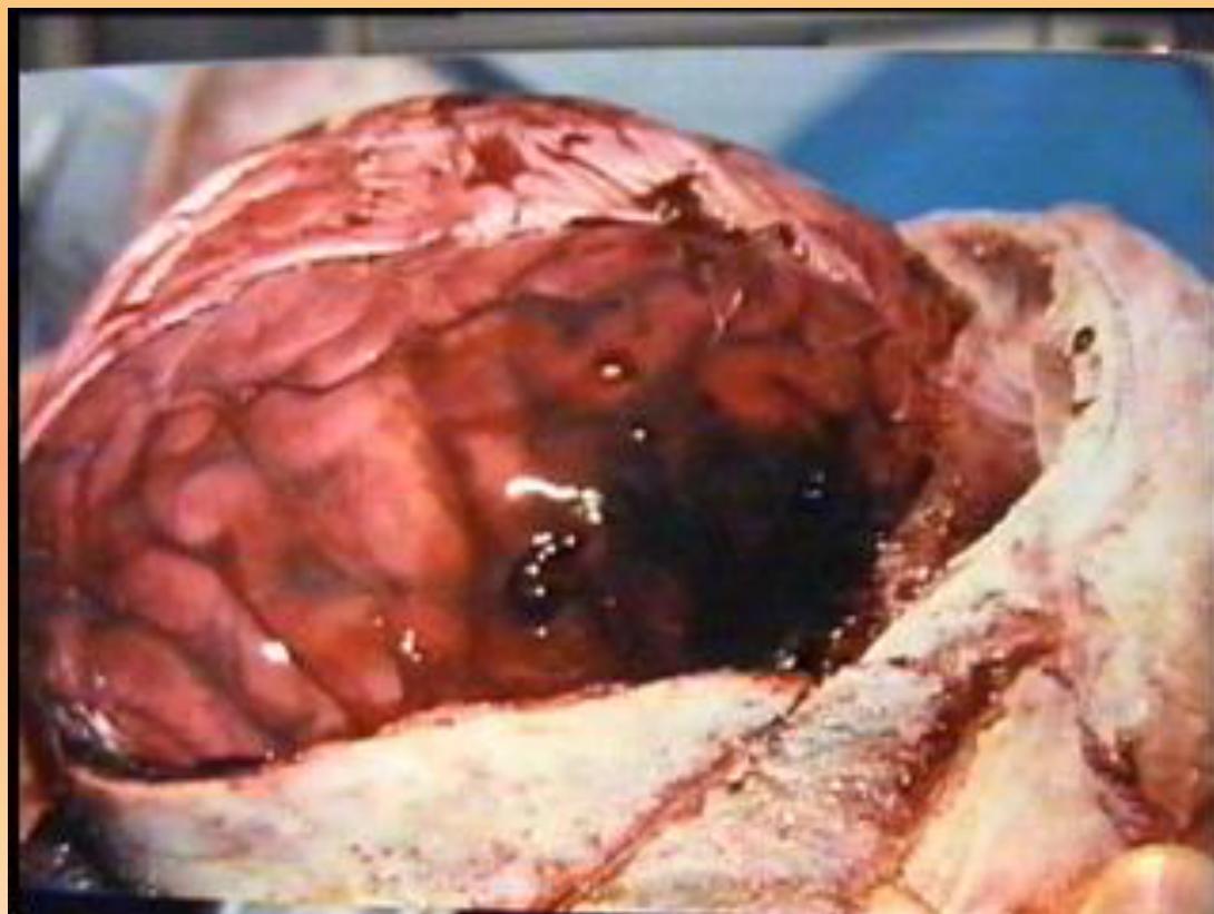 _page_128_Picture_4.jpeg|315x237