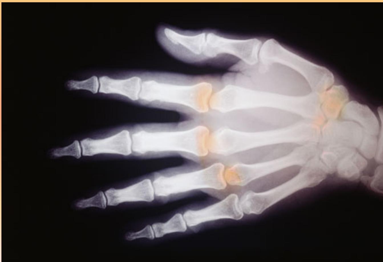 _page_134_Picture_1.jpeg|238x163