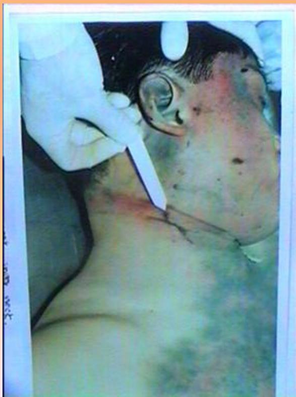 _page_145_Picture_2.jpeg|195x261