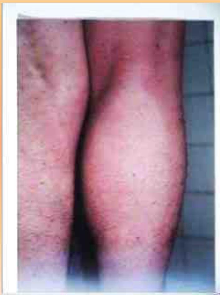 _page_147_Picture_1.jpeg|326x437