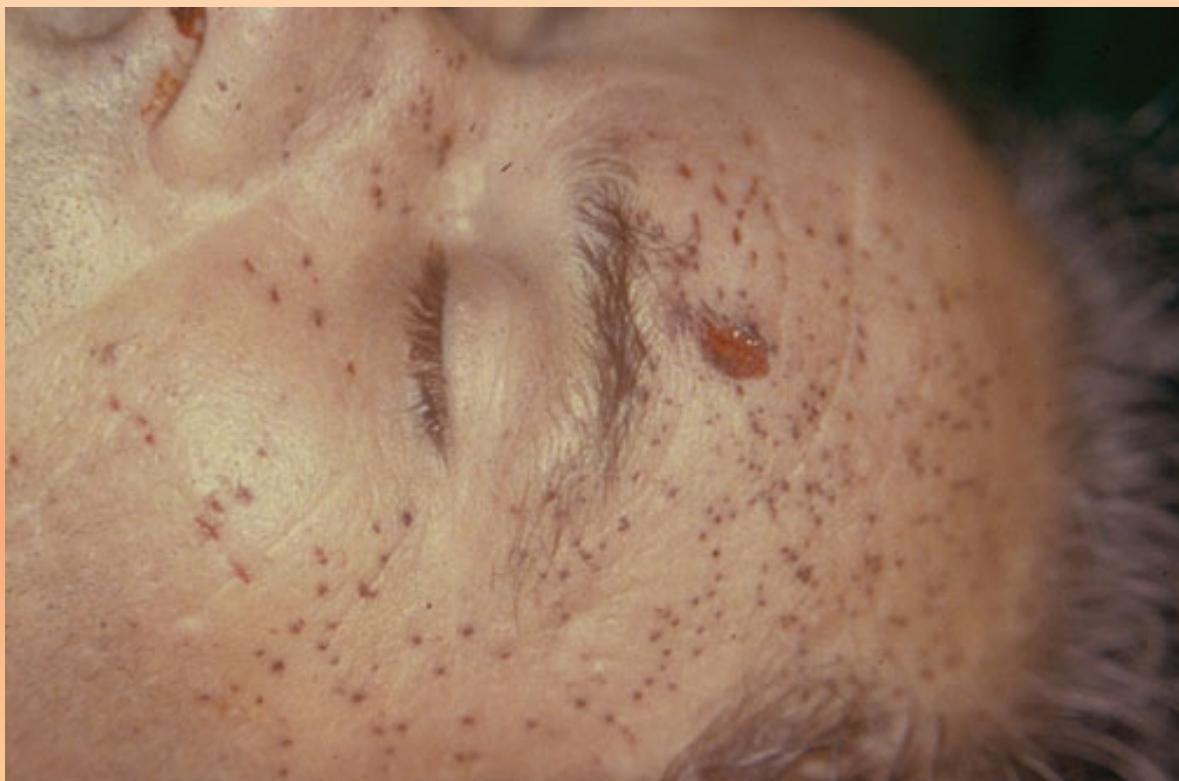 _page_154_Picture_5.jpeg|227x150