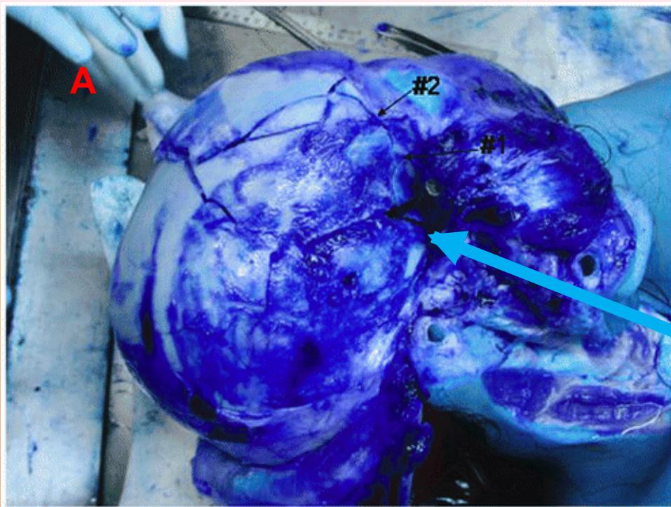 _page_156_Picture_1.jpeg|261x197