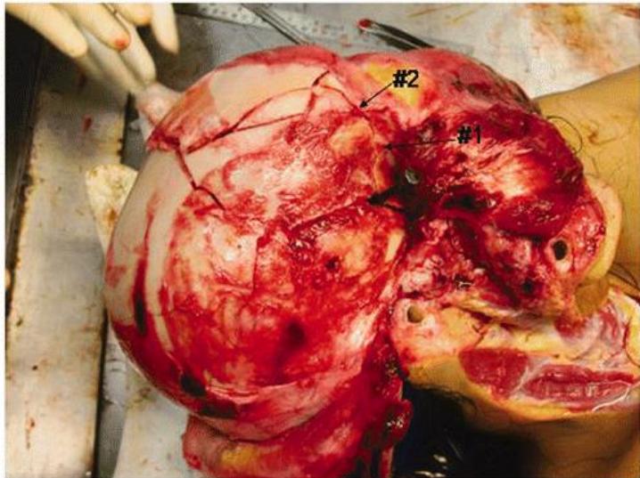 _page_19_Picture_5.jpeg|316x236