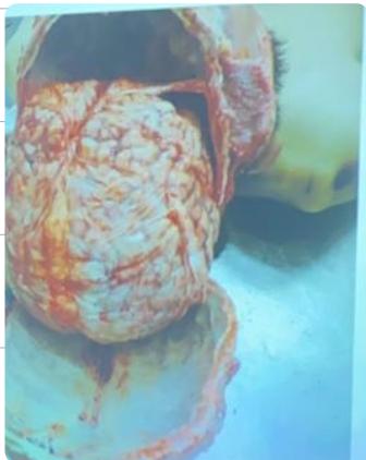 _page_39_Picture_0.jpeg|136x171