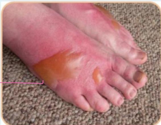 _page_3_Picture_1.jpeg|150x116