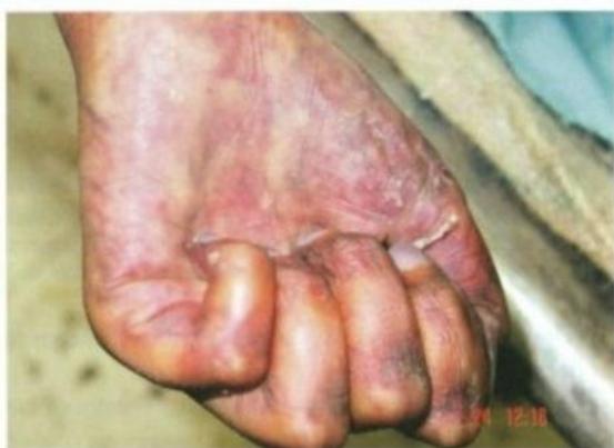 _page_3_Picture_4.jpeg|271x197