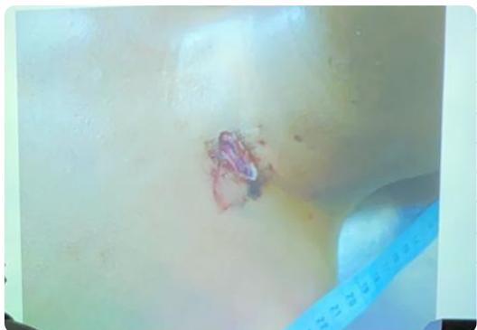 _page_40_Picture_0.jpeg|241x166