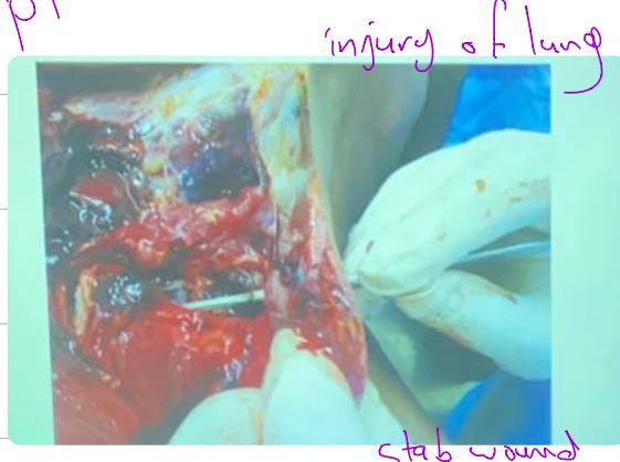 _page_40_Picture_5.jpeg|236x176