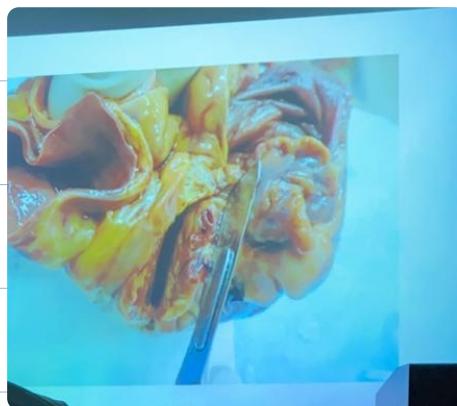 _page_41_Picture_1.jpeg|171x152