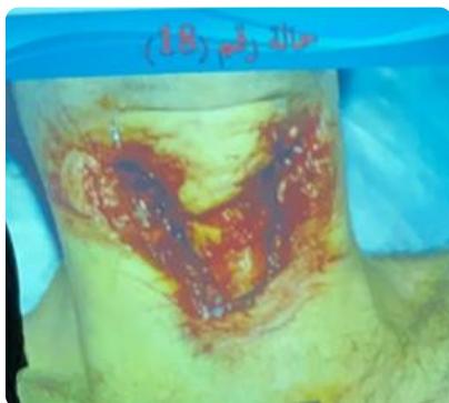 _page_44_Picture_3.jpeg|236x212