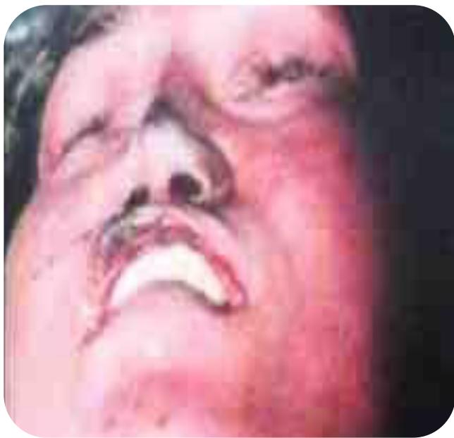 _page_49_Picture_2.jpeg|195x188