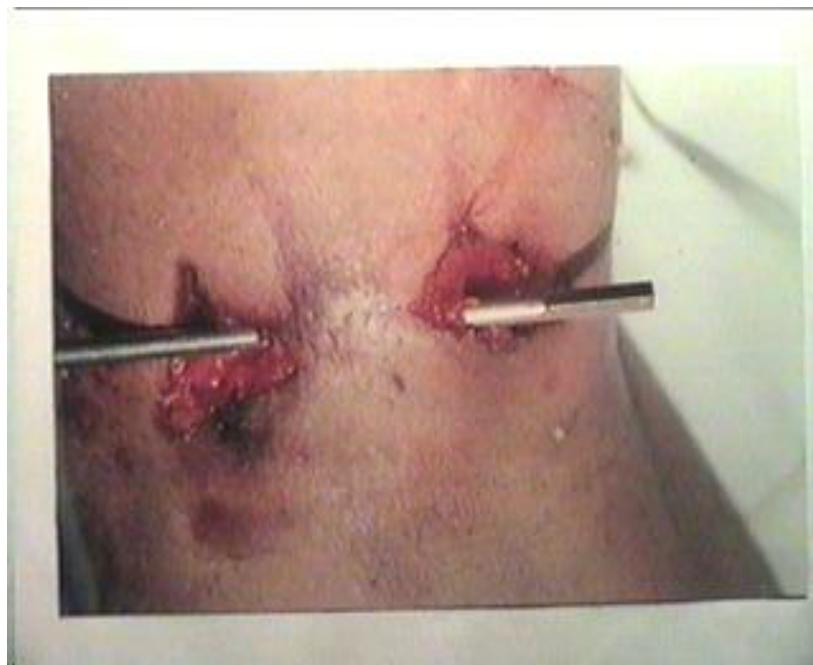 _page_57_Picture_2.jpeg|311x254