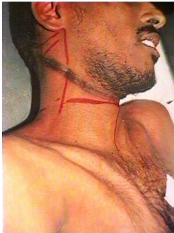 _page_64_Picture_3.jpeg|180x241