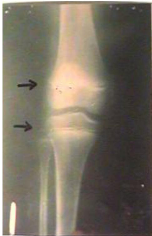 _page_65_Picture_2.jpeg|161x250