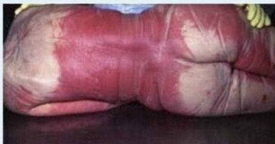 _page_6_Picture_3.jpeg|304x159