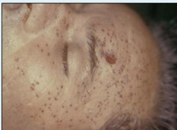 _page_7_Picture_3.jpeg|245x179