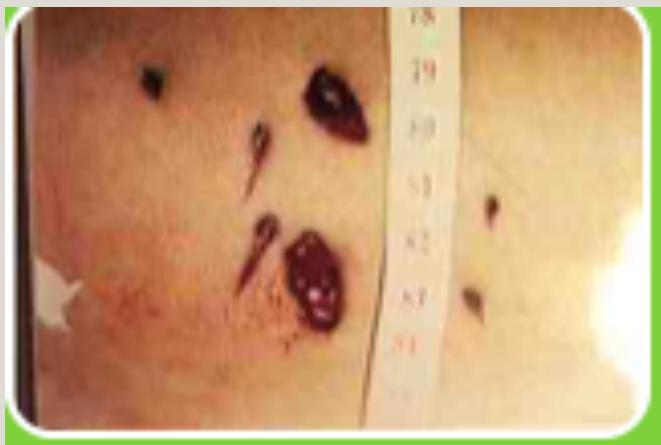 _page_91_Picture_1.jpeg|270x182