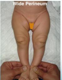 Additional deformity examples