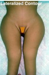 More deformity examples