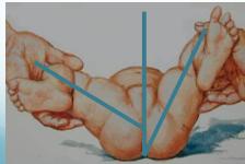 Simultaneous abduction/adduction in flexion