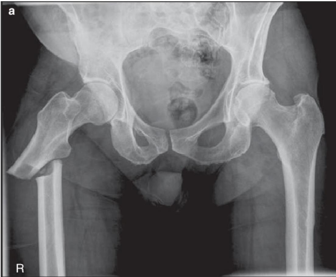 _page_37_Picture_1.webp|375x309