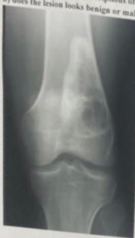 _page_43_Picture_5.webp|150x263