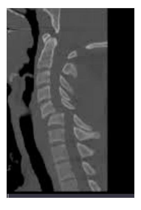 Jumped facet|226x335