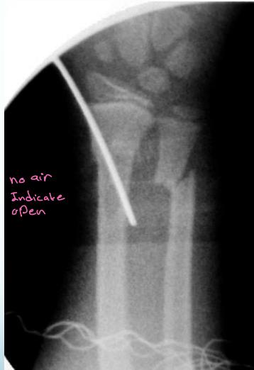 _page_10_Picture_4.jpeg|237x346