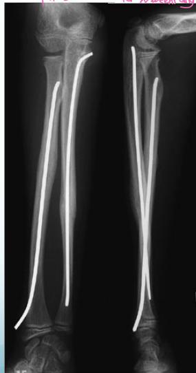 _page_11_Picture_5.jpeg|193x367