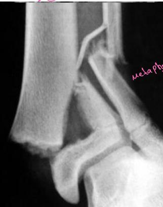 _page_18_Picture_6.jpeg|259x328