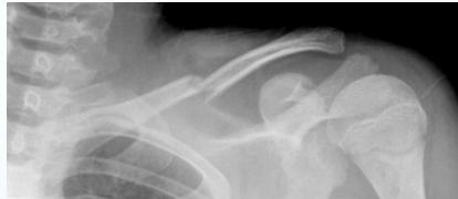 _page_23_Picture_7.jpeg|332x180