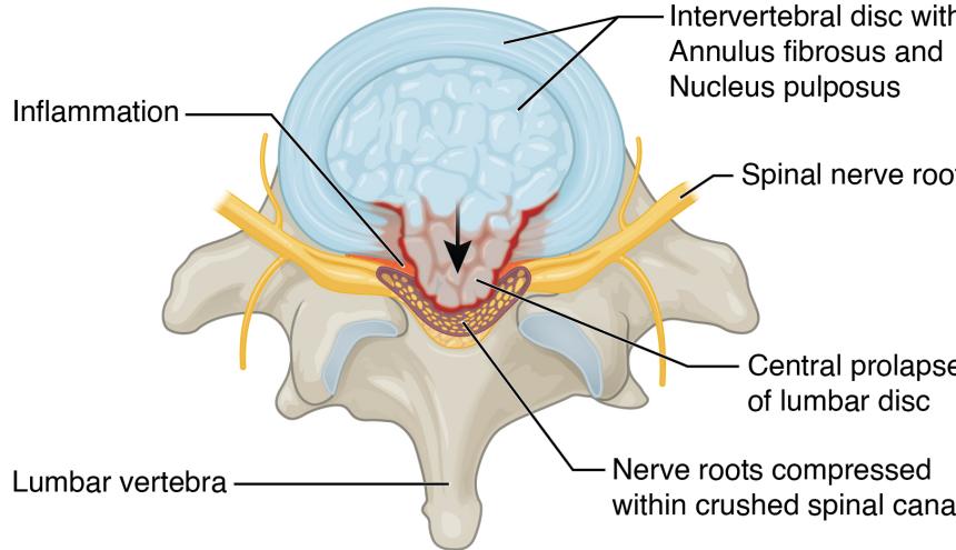 _page_47_Picture_5.jpeg|389x224