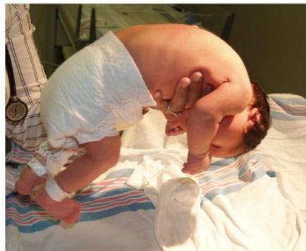 img-107.jpeg|179x147