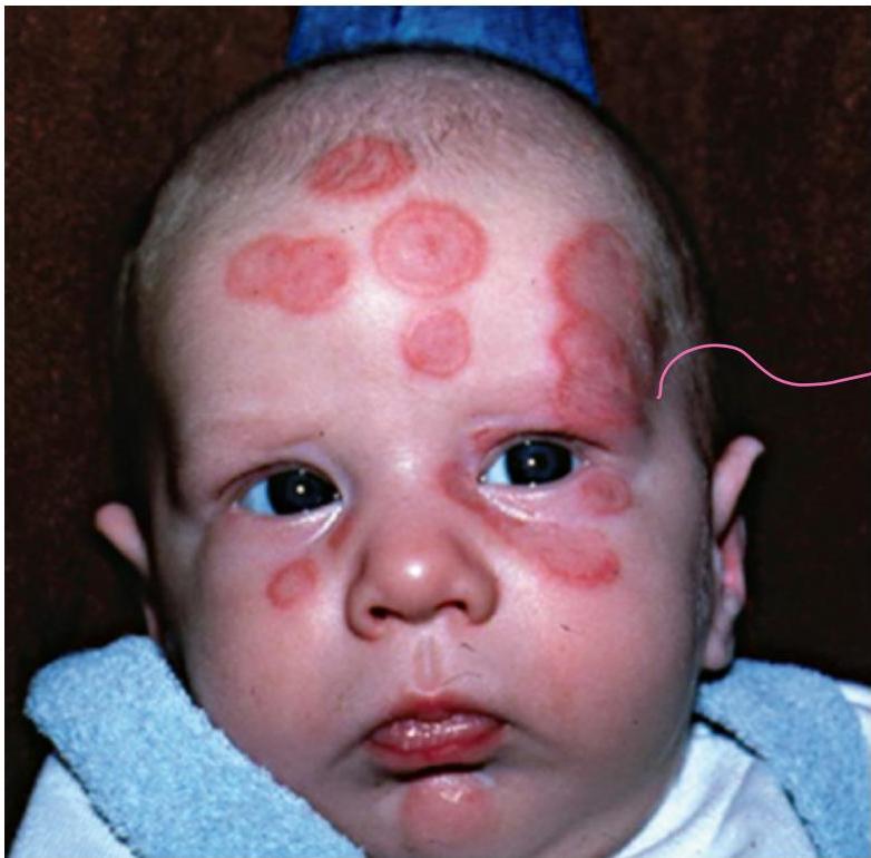 img-109.jpeg|156x154