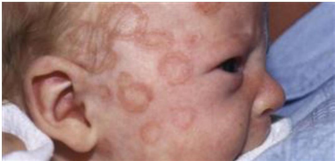 img-118.jpeg|301x145