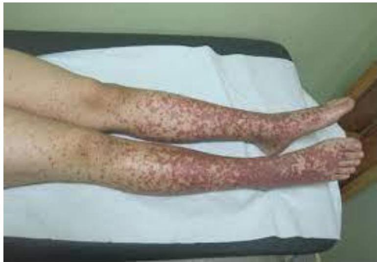 img-121.jpeg|202x235