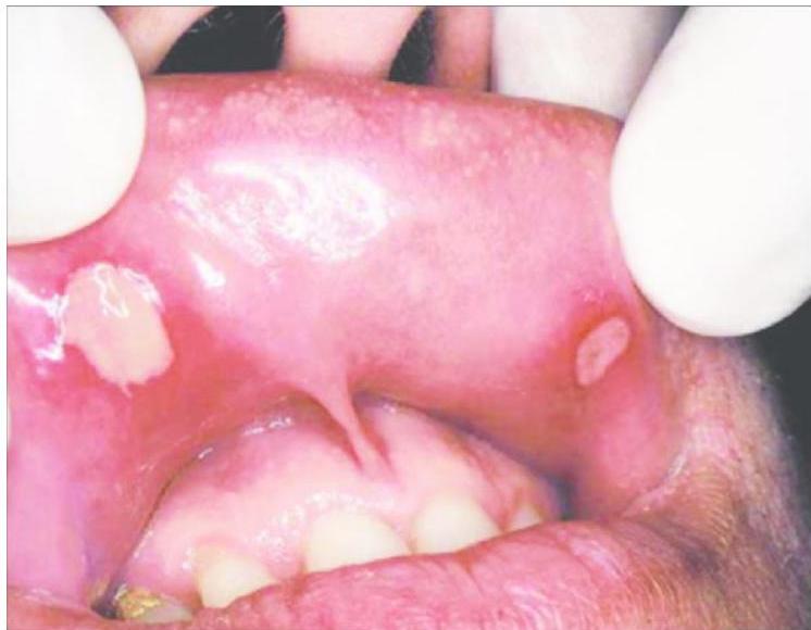 img-122.jpeg|289x225