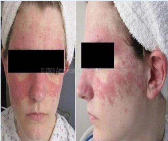 img-130.jpeg|182x153