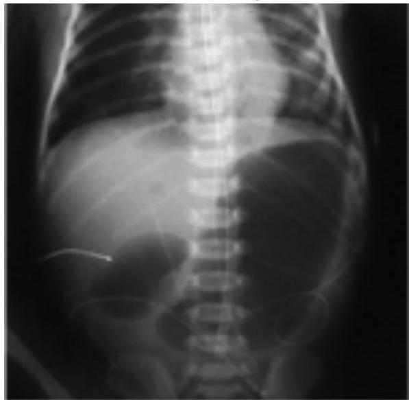 img-179.jpeg|257x251