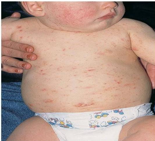 img-186.jpeg|340x309